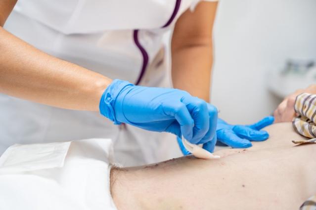 Soins post-opératoires